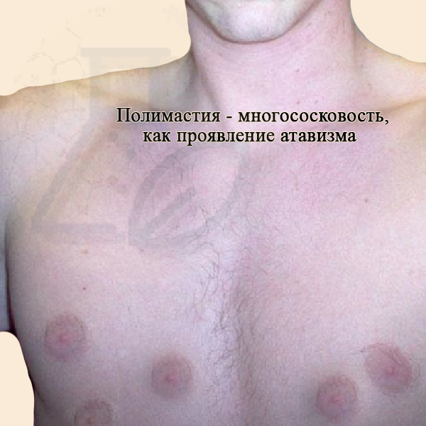 Полимастия - атавизм