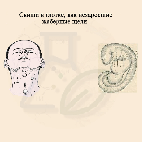 Свищи в глотке