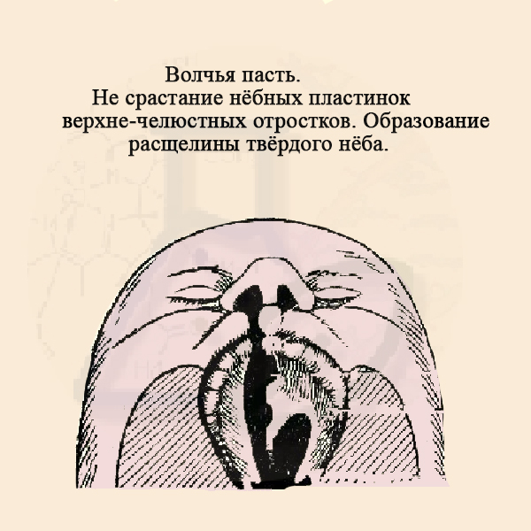 Волчья пасть